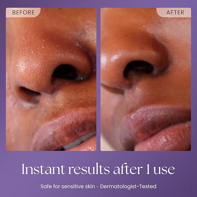 Prakti PritiPolish Instant Glow Exfoliator, Gentle Facial Scrub Clears & Minimizes Pores, Instantly Smooths & Softens with Natural AHAs, 1 oz
