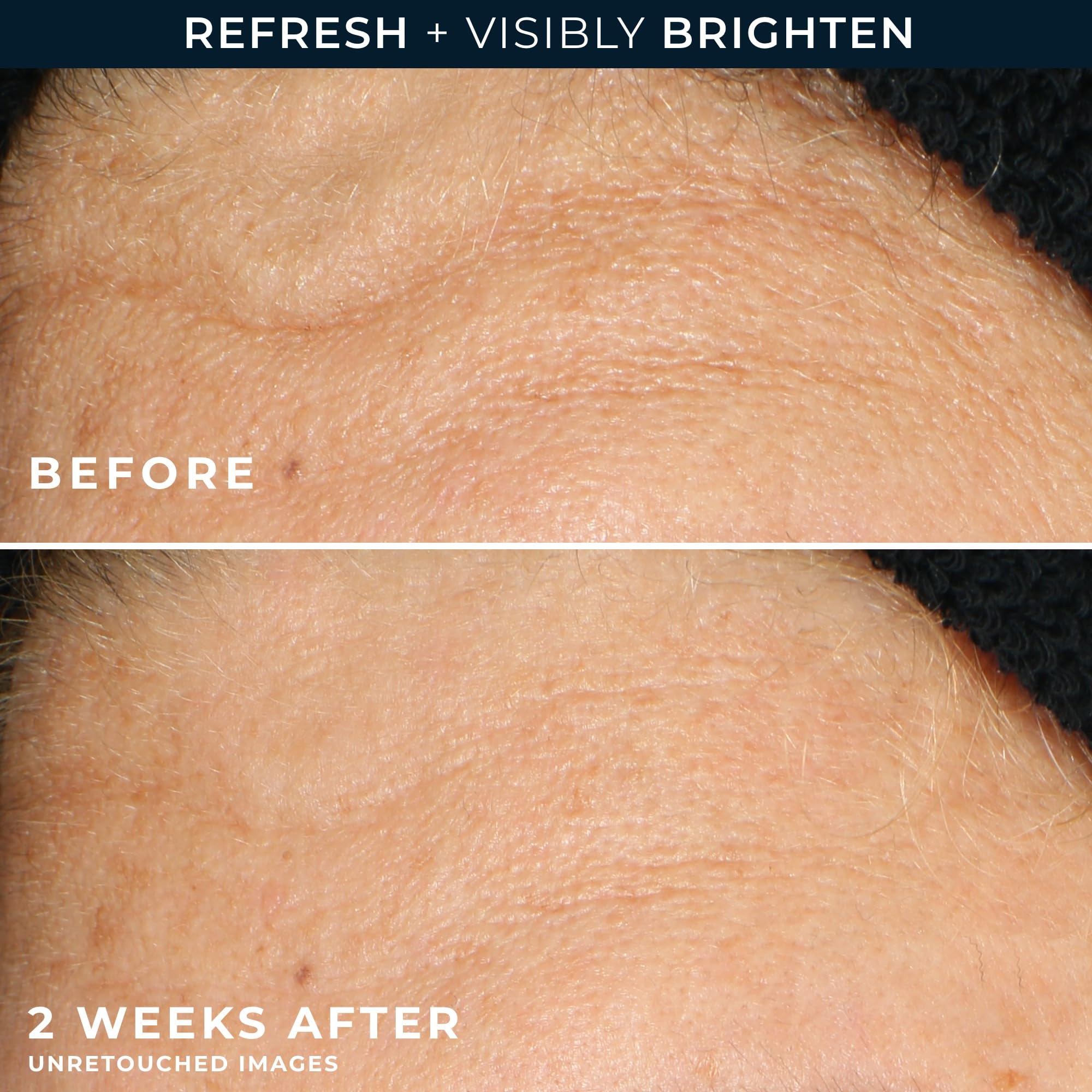 RoC Multi Correxion Revive + Glow Vitamin C Gel Brightening Cleanser, 6 oz