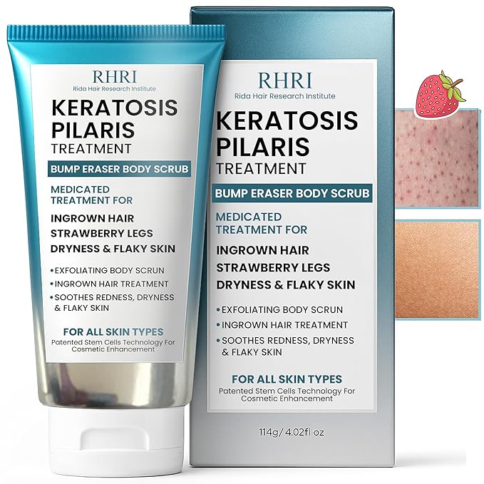 KP Bump Eraser Body Scrub with 10% AHA | Keratosis Pilaris Treatment | Bump Eraser Body Scrub | Clears Strawberry Legs | Soothes Redness, Dryness & Flaky Skin