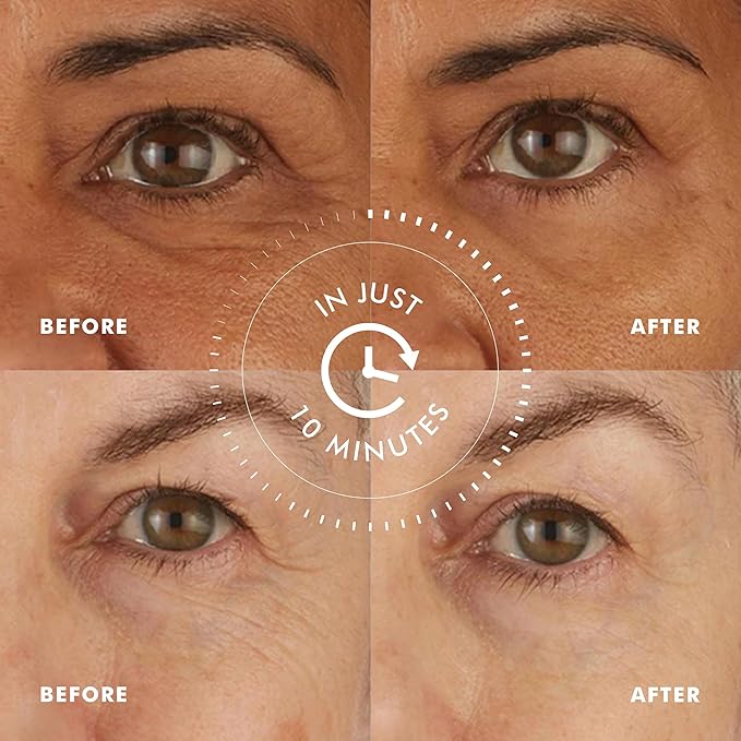 Skyn ICELAND Hydro Cool Firming Eye Patches For Puffy Eyes and Dark Circles