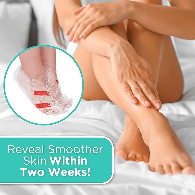 DERMORA Foot Peel Mask | Skin Exfoliating Foot Masks for Dry, Cracked Feet & Callus Removal | Dead Skin Exfoliator for Baby Soft Feet | Pack of 4 | Regular (Fits up to Men 10 / Women 11) | Original