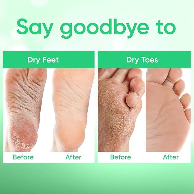 Foot Peel Mask - Foot Mask for Baby Soft Skin - Remove Dead Skin, Dry, Cracked Feet & Callus, Foot Spa, Made with Aloe Vera Extract for Women and Men (2 Pairs, Peppermint)
