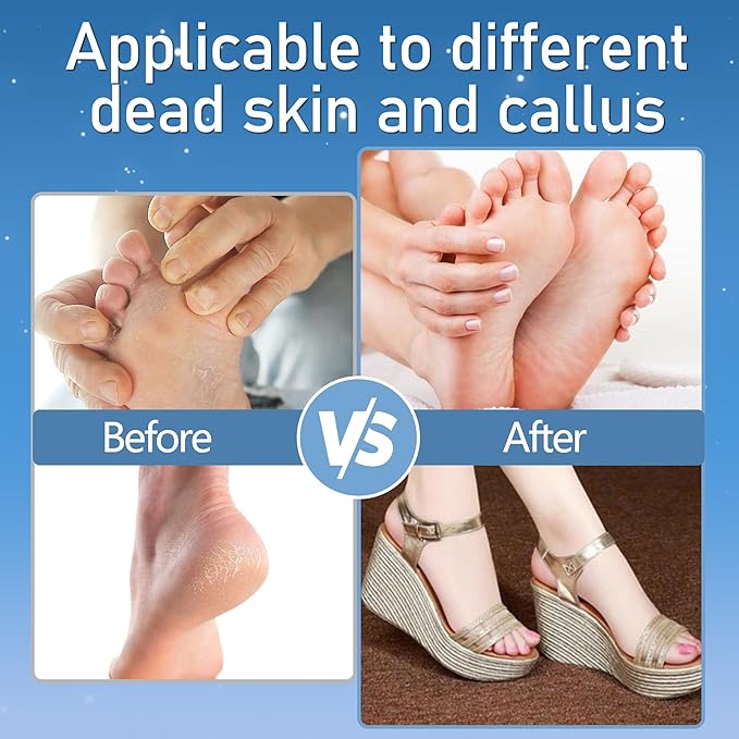 Callus Remover for Feet, Electric Foot Callus Remover Waterproof with 3 Rollers 2 Speed Battery Display,17 in1 Rechargeable Foot File Pedicure Kits for Dead Hard Cracked Dry Skin（White