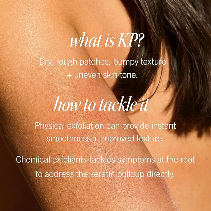 First Aid Beauty KP Bump Eraser Body Scrub Exfoliant for Keratosis Pilaris with 10% AHA 4 oz.