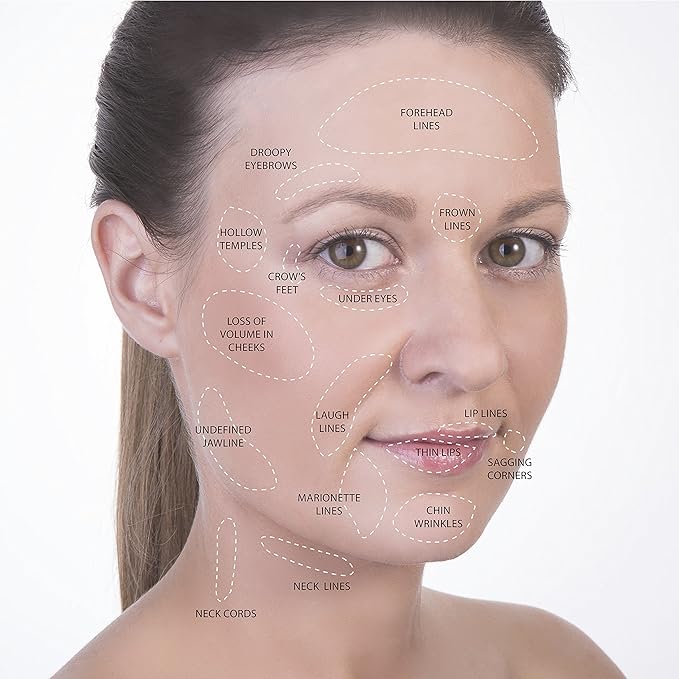 Body Cupping Therapy Sets - Sandine Face Cupping Set - Facial Cupping System - Silicone Massage Cups - Cupping for Cellulite Kit - Ideal to Shape your Cheeks, Chin by Sandine