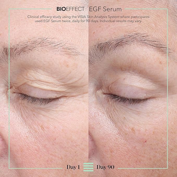 BIOEFFECT EGF Serum with Growth Factor | Firming, Age Defying Face Serum